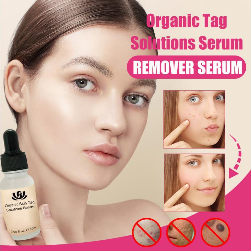 Organic Skin Tags Solutions Serum 30g No Trace Painless Skin Tag Remover Serum for Face Wart Mole Freckle TSLM1
