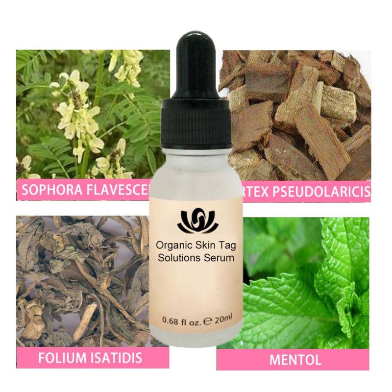 Organic Skin Tags Solutions Serum 30g No Trace Painless Skin Tag Remover Serum for Face Wart Mole Freckle TSLM1