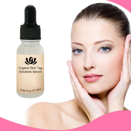 Organic Skin Tags Solutions Serum 30g No Trace Painless Skin Tag Remover Serum for Face Wart Mole Freckle TSLM1